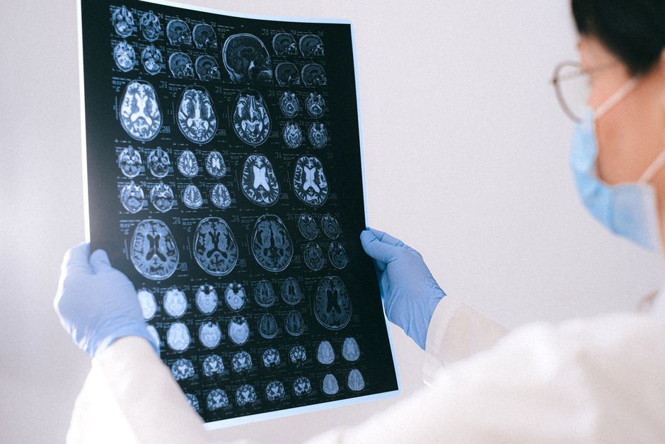 Did You Know? 10 Mind-Blowing Facts About the Human Brain